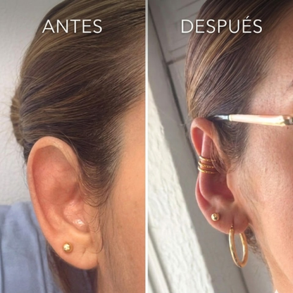 Correctores de oreja - ¡Junior!